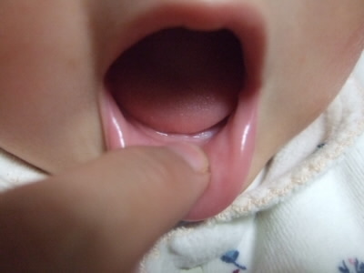 赤ちゃん　下の歯が生える
